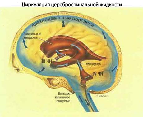 Nadagdagang presyon ng intracranial 