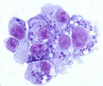 Mga pathogens ng anaplasmosis ng tao (pamilya Anaplasmataceae)