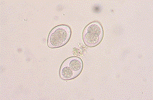 Coccidia - causative agent ng coccidioidosis