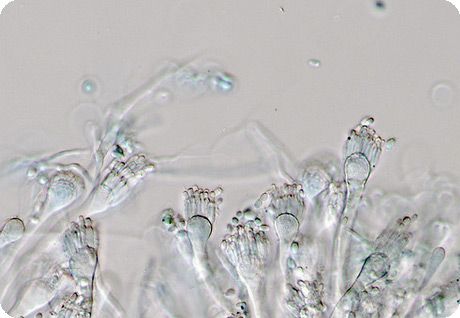 Isa sa mga fungi ng genus Aspergillus 