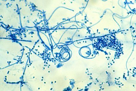 Ang causative agent ng epidermophytosis ng paa (Trichophyton interdigitale)