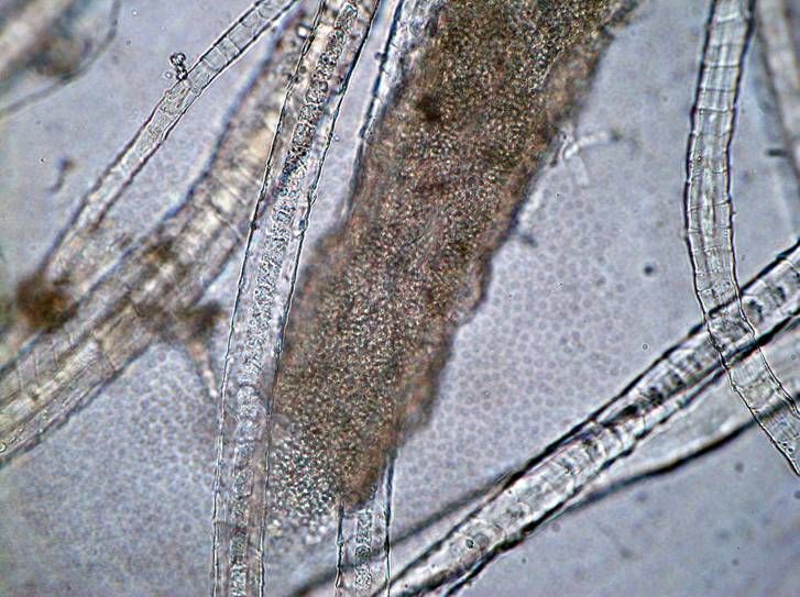 Mga pathogens ng epidermophytosis